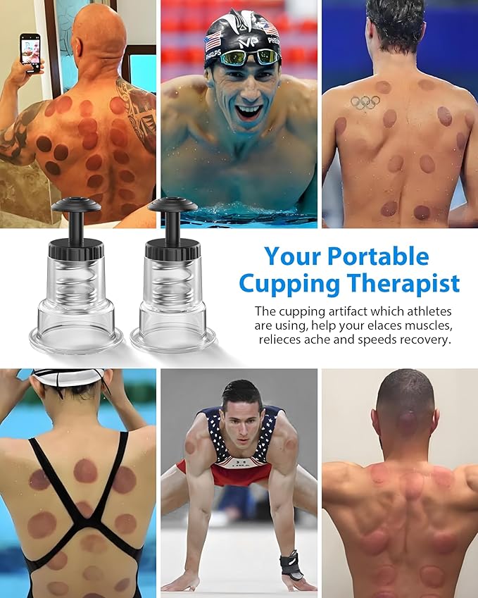 Cupping Kit for Massage Therapy, 2 Sizes Cupping Set, Unique Piston Design, Portable Massager for Studio & Home Use, Muscle Pain Relief, Myofascial Release, Cellulite Reduction (6 Pack)