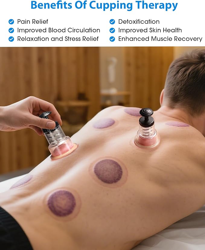 Cupping Kit for Massage Therapy, 2 Sizes Cupping Set, Unique Piston Design, Portable Massager for Studio & Home Use, Muscle Pain Relief, Myofascial Release, Cellulite Reduction (4 Pack)